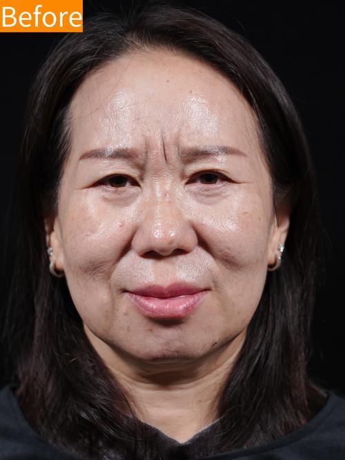 疤痕论坛2026最新
