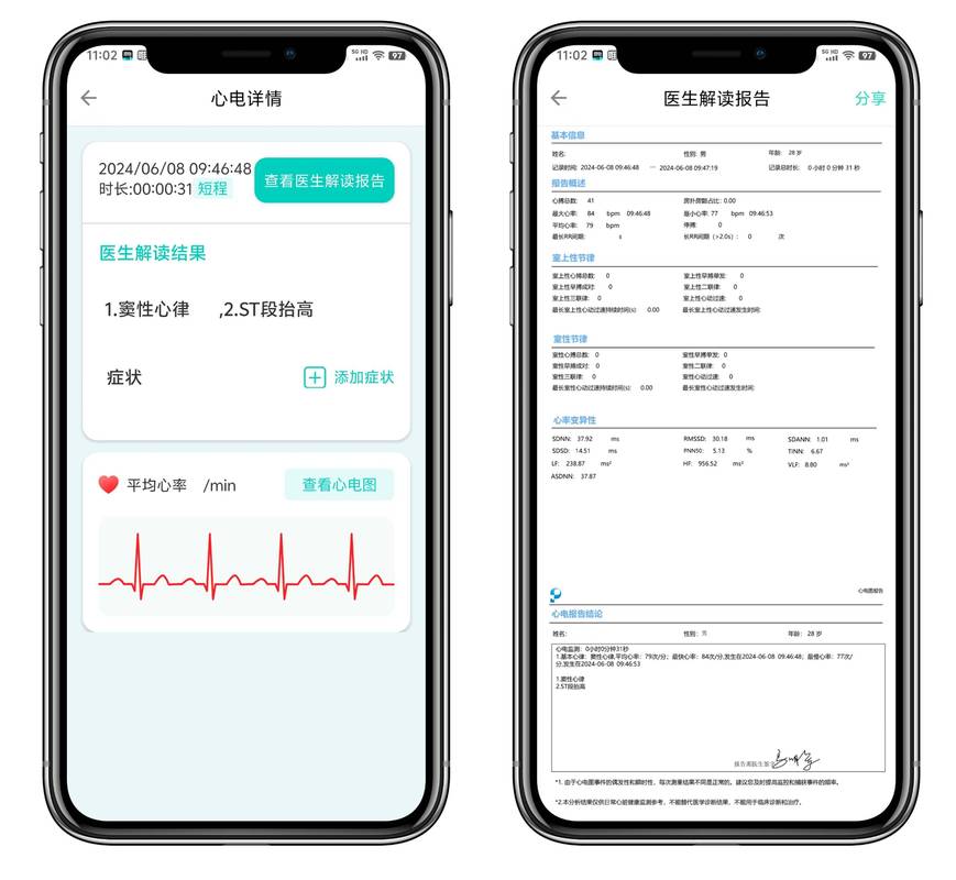 心电图分析软件2026最新
