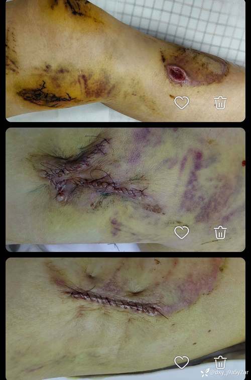 中国疤痕论坛2026最新
