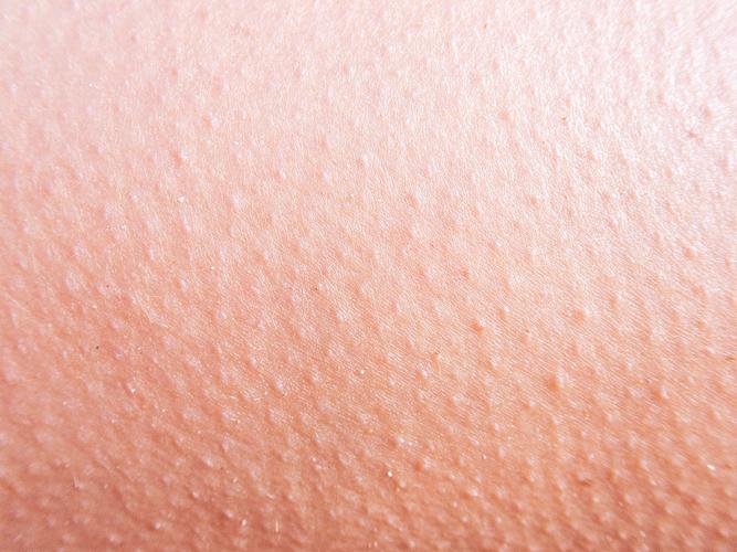 肌肤的纹理下载2026最新版
