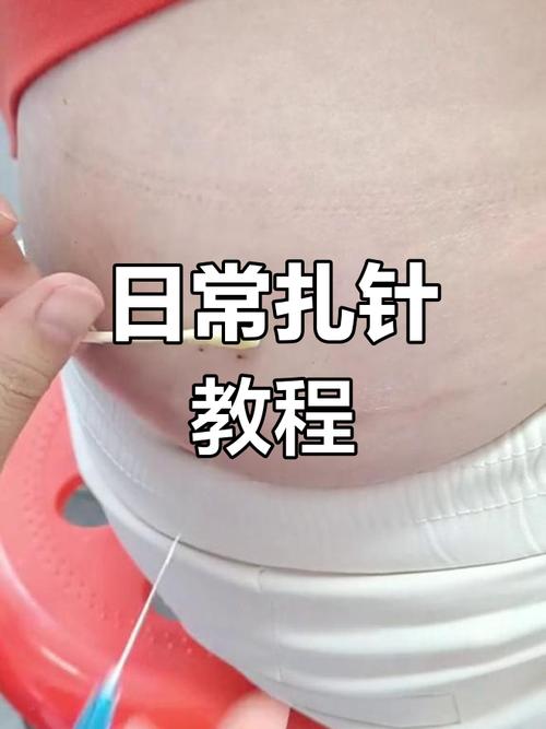 肌肉注射操作视频2026