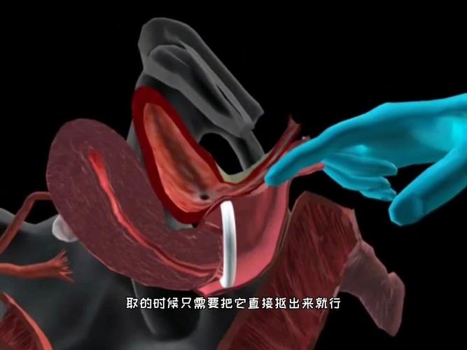 插入阴道的视频2026