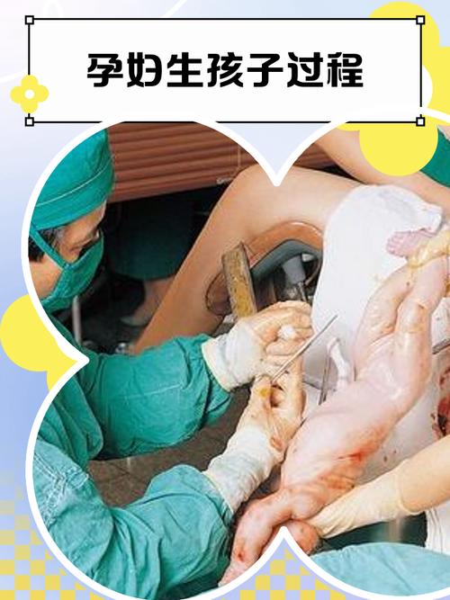 angelababy生孩子视频2026