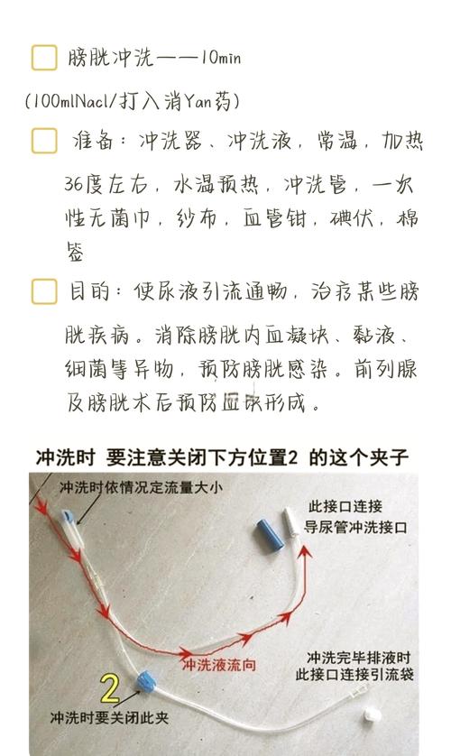 冲洗器使用方法视频2026